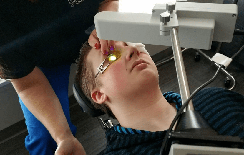 Reticularea elimină eficient keratoconusul la începutul dezvoltării sale
